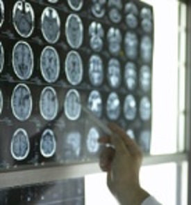 brain scans are used in determining traumatic brain injury