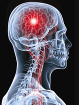Traumatic Brain Injury - Altizer Law, P.C.