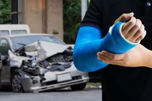 Person with arm in blue cast stands in front of a damaged car from a collision.